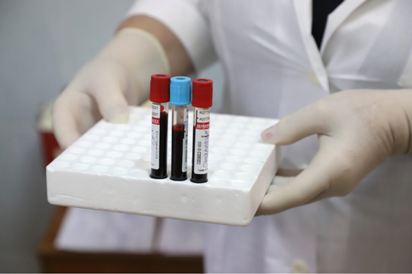 Более 25 литров крови сдали калужане в рамках донорской акции