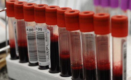 Дмитрий Медведев утвердил Правила ведения единой базы данных донорства крови и ее компонентов