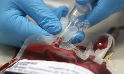 26 сентября в Перми пройдет акция "Университет-территория здоровых сердец" 