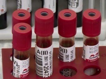 Череповчане стали участниками донорской акции «Эликсир добра» 