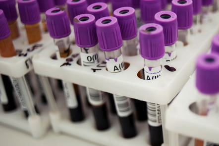 Новосибирские студенты дарят свою кровь 