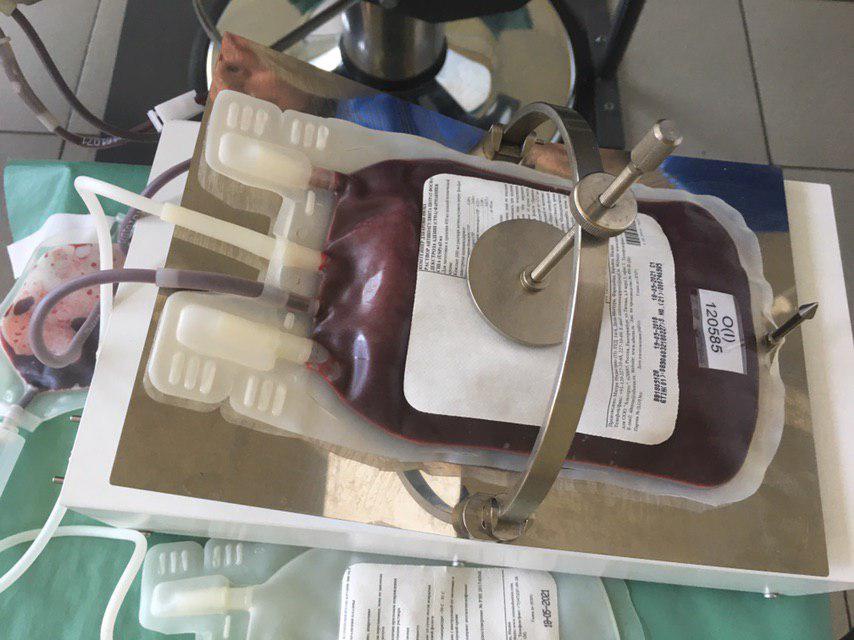 В МГКБ ждут доноров. 