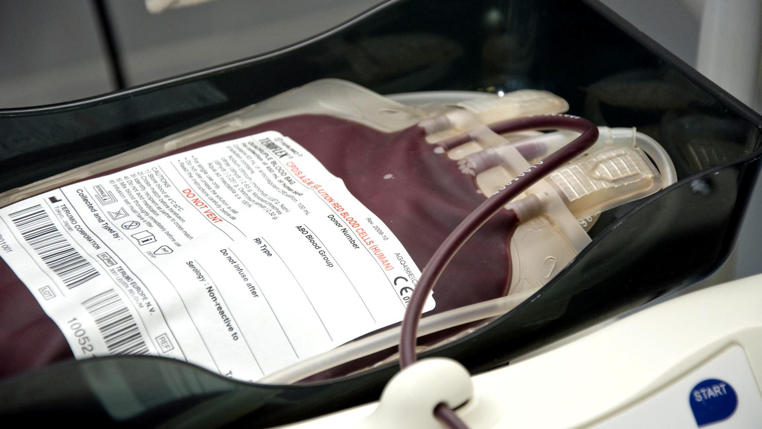 В Вологде «Донорский светофор» оповестил о нехватке крови 